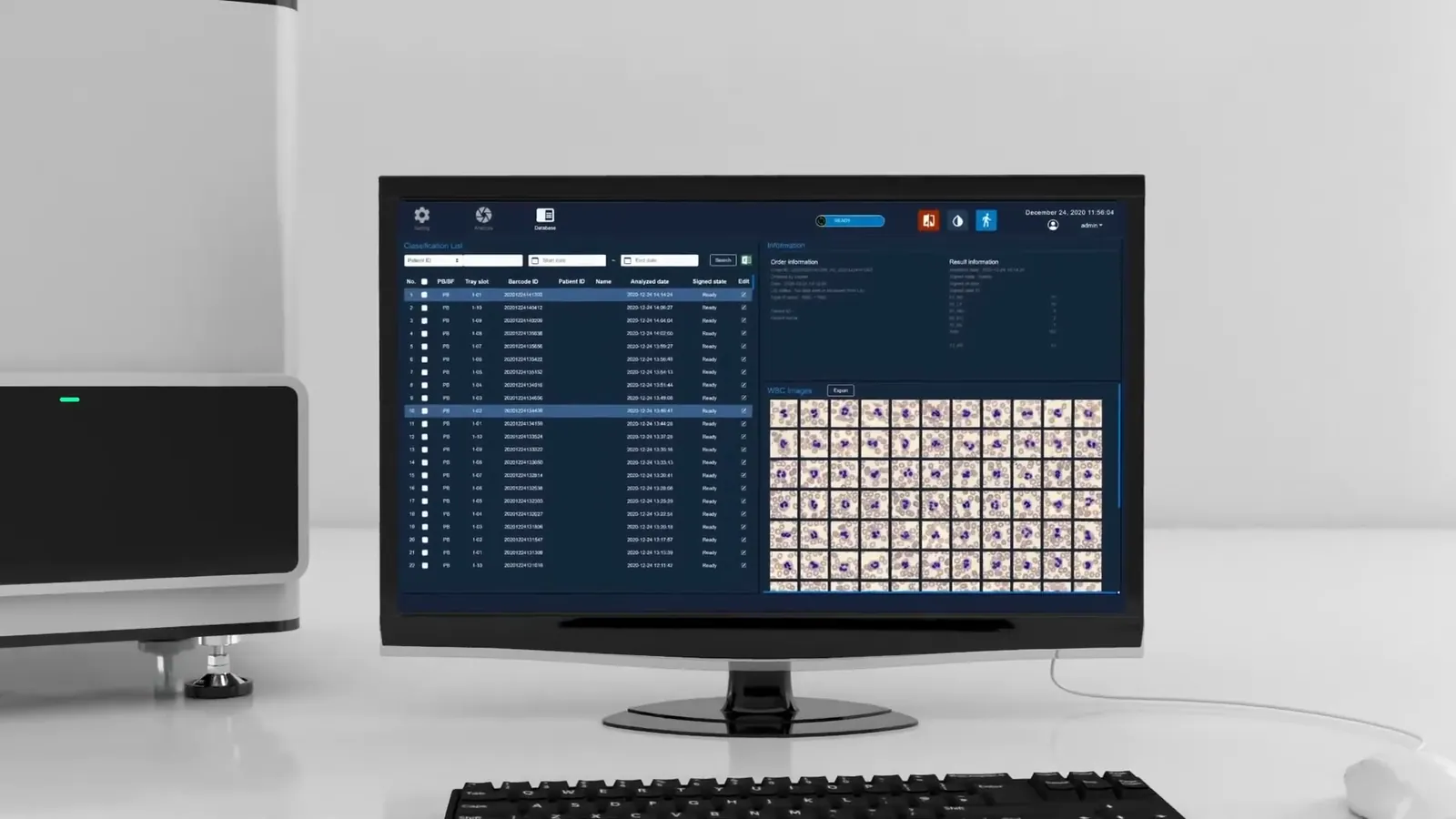 UMID PBIA 제품 소개 영상 대표 장면