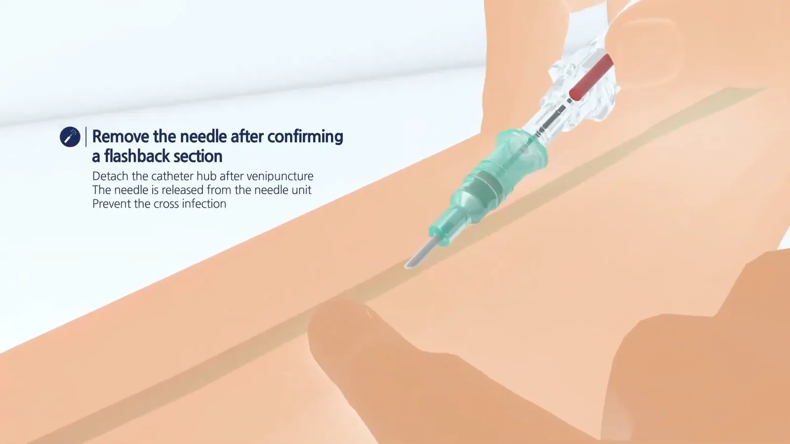 WOOYOUNG MEDICAL MAGICAS 제품 소개 영상 대표 장면